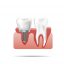 Freepik Healthy Teeth And Dental Implant Realistic Illustration Of Tooth Medical Dentistry